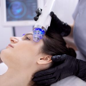 Rf-microneedling